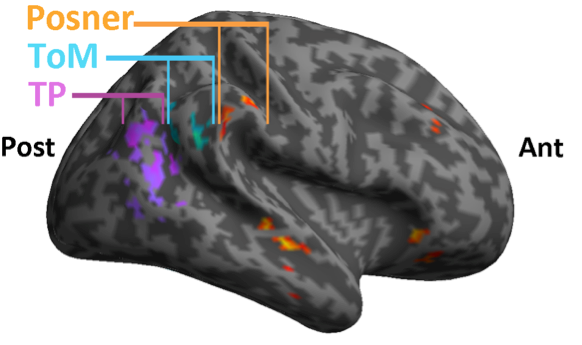 cerebro_cics_billeke